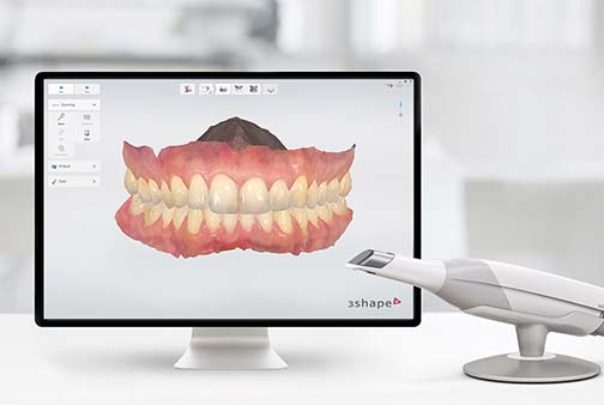 dentanela-skener-technologie